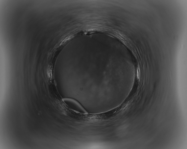 X0000087681155200705041023