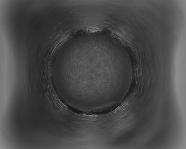 X0000087681393200705041020