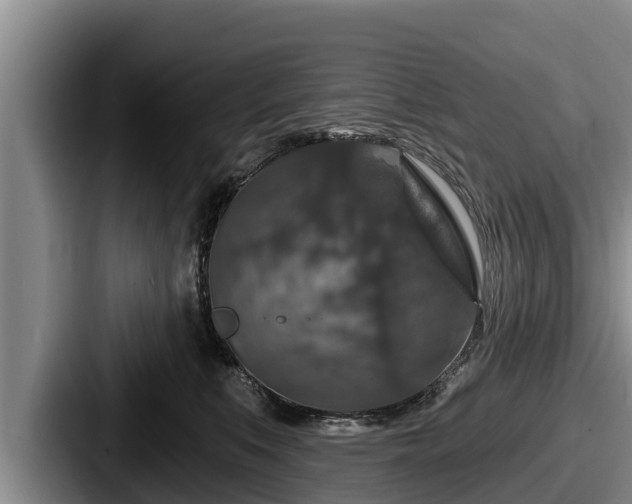 X0000087680519200705111303