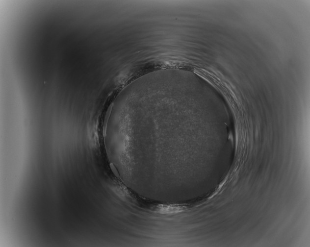 X0000087680520200705111303