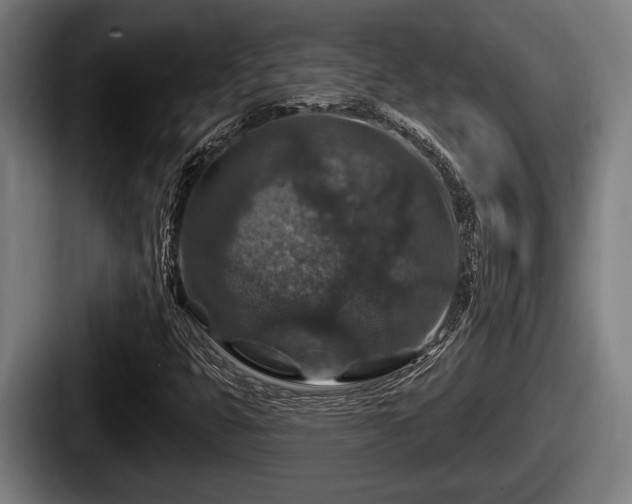 X0000087681399200705111251