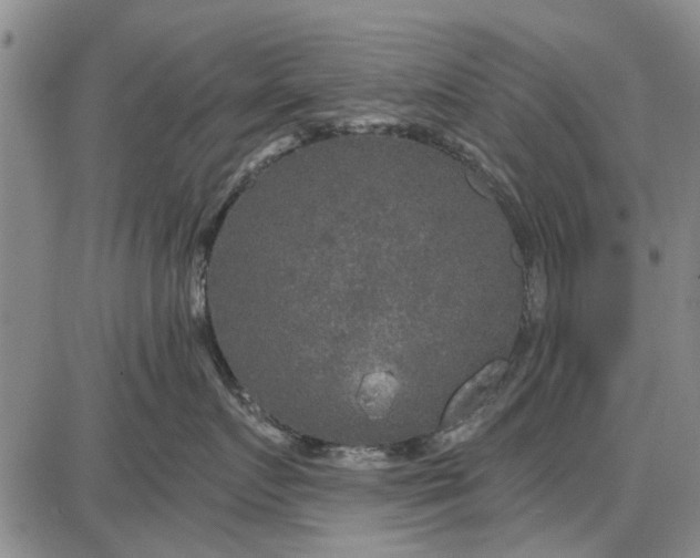 X0000087680719200705181729