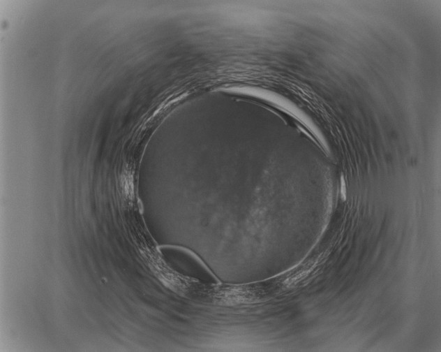 X0000087681155200705181722