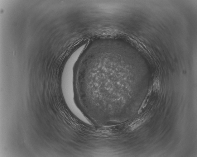 X0000087681156200705181722