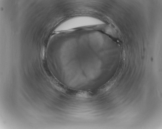 X0000087680076200706011705