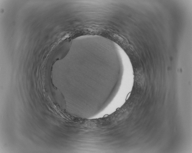 X0000087681009200706011648