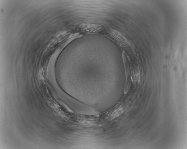 X0000087681010200706011649