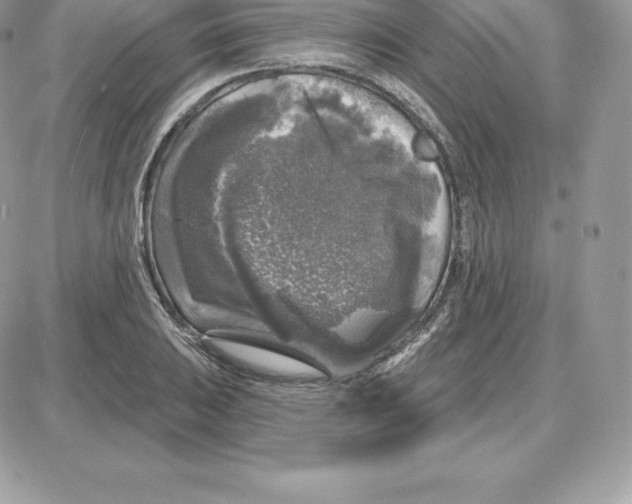 X0000087681031200706011649