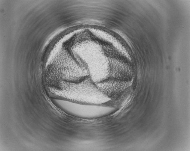 X0000087681115200706011647