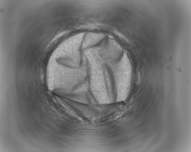 X0000087681206200706011645