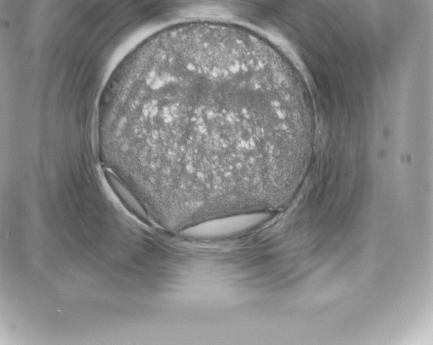 X0000087681295200706011645