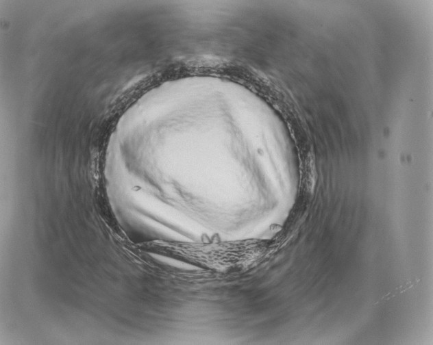 X0000087681301200706011644