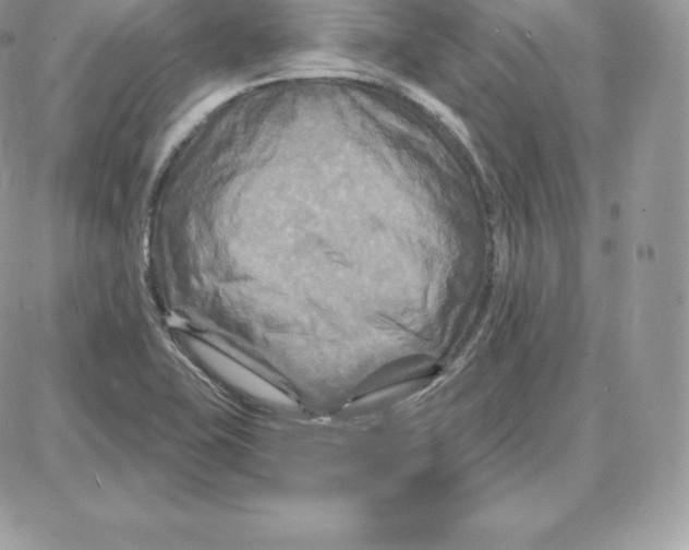 X0000087681415200706011643