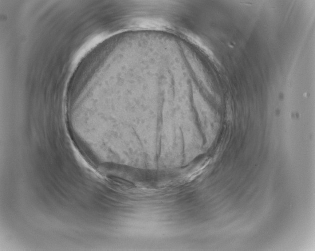 X0000087681471200706011642