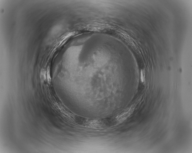 X0000087691155200705041030