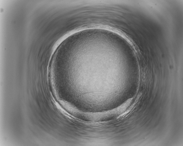 X0000087691535200705041025