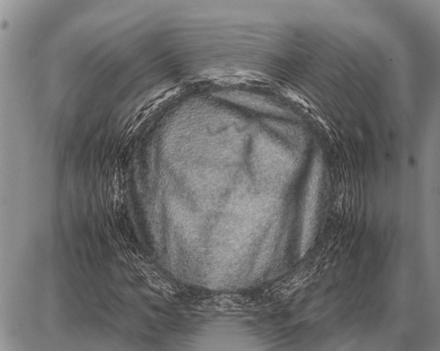 X0000087690966200705181750