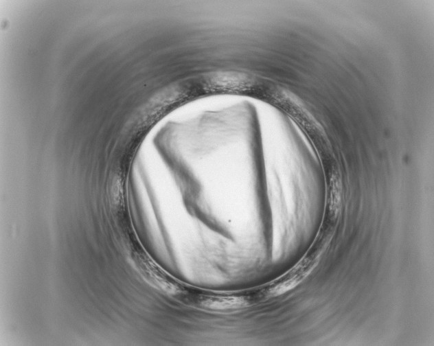 X0000087690459200705251713