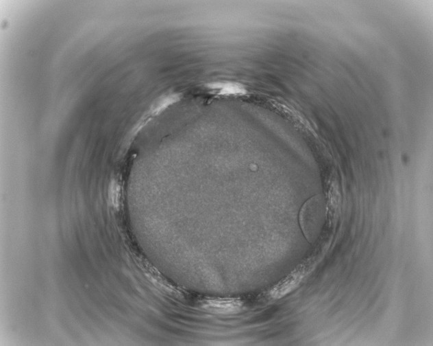 X0000087690659200705251710