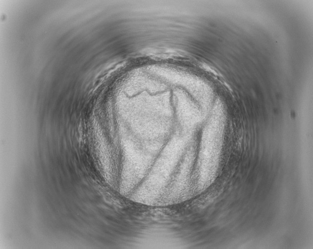 X0000087690966200705251704