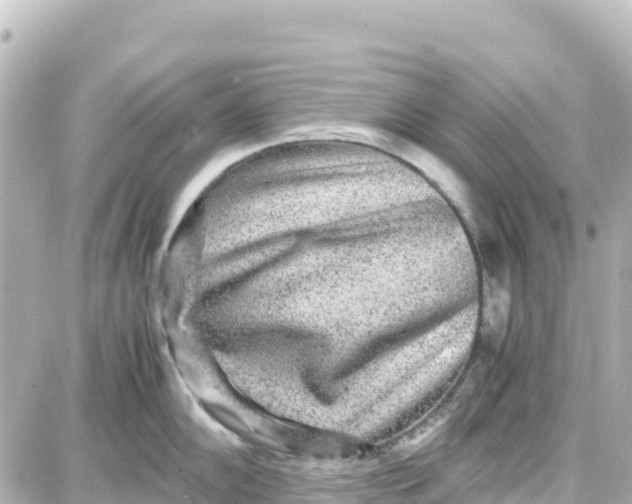 X0000087691102200705251702