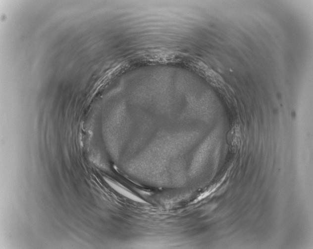 X0000087691202200705251700