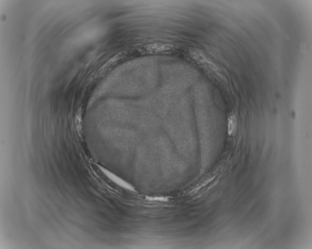 X0000087691011200706011714