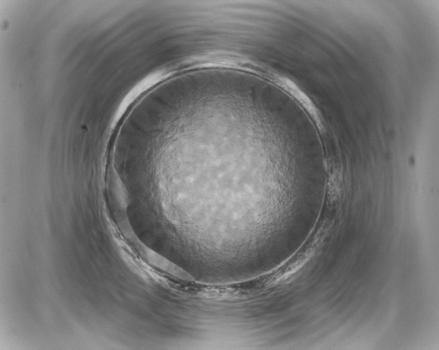 X0000087701146200705041056