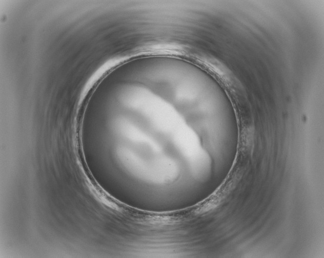 X0000087701470200705041050