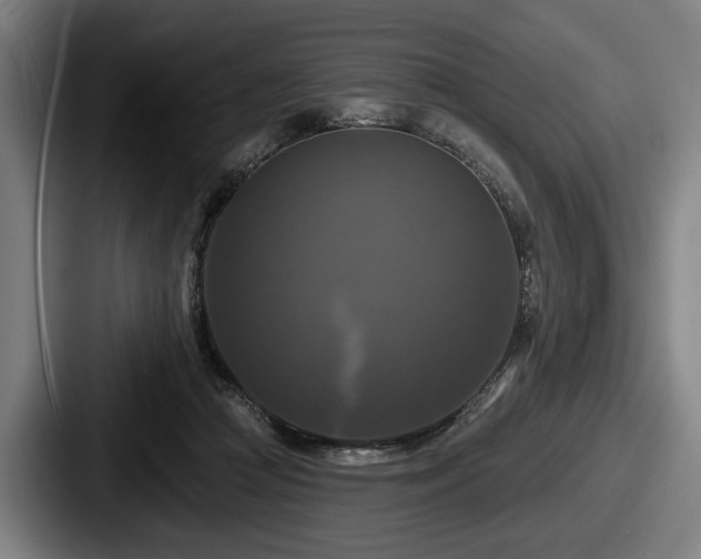 X0000087700361200705111407