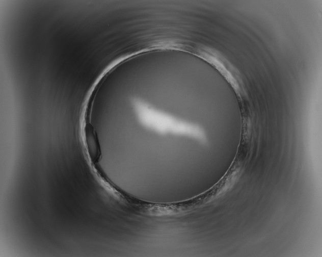 X0000087700955200705111401