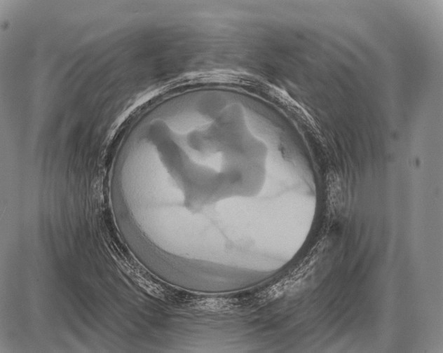 X0000087701166200705181812