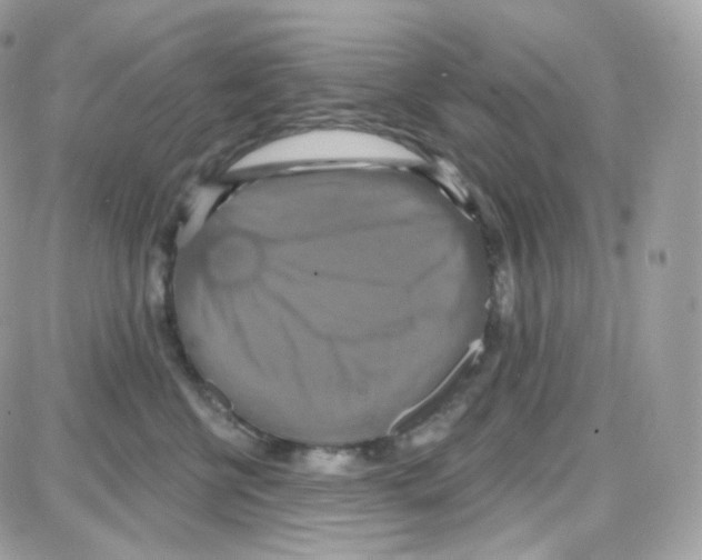 X0000087700570200706011748