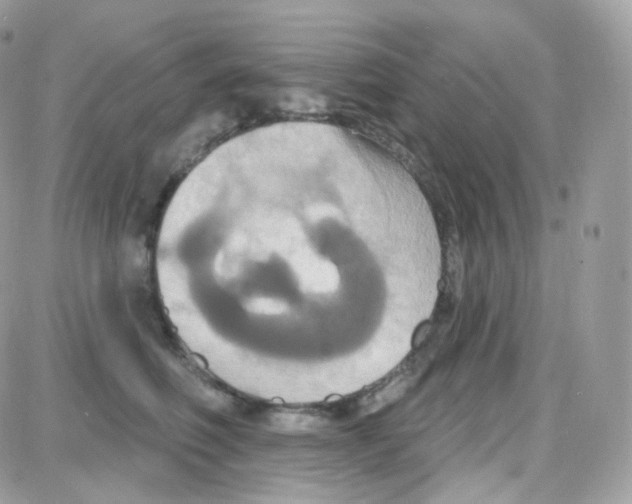 X0000087700614200706011746