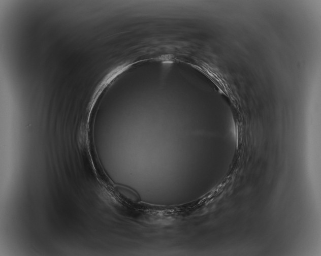X0000087710147200705041105
