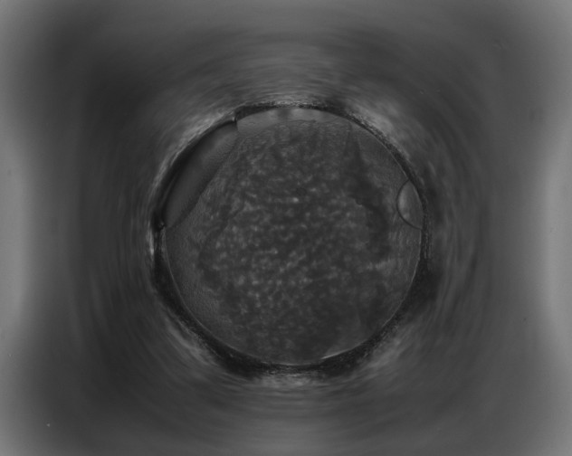 X0000087710299200705041103