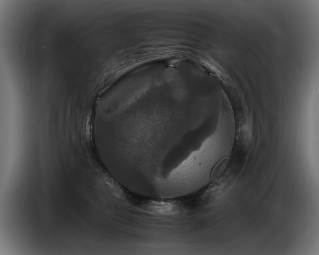 X0000087710469200705041101