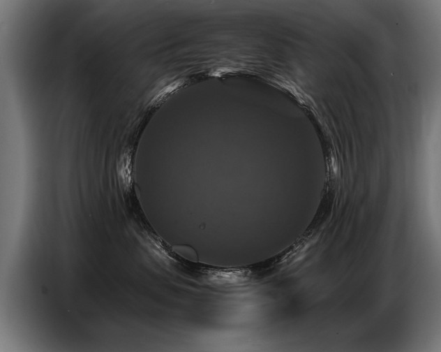 X0000087710479200705041102
