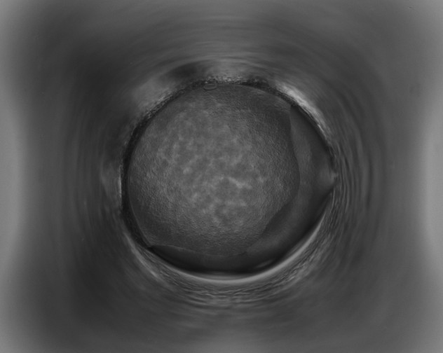X0000087710493200705041101