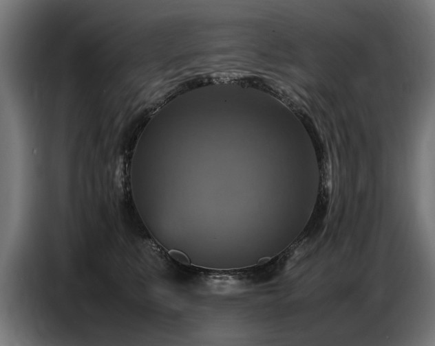 X0000087710519200705041101