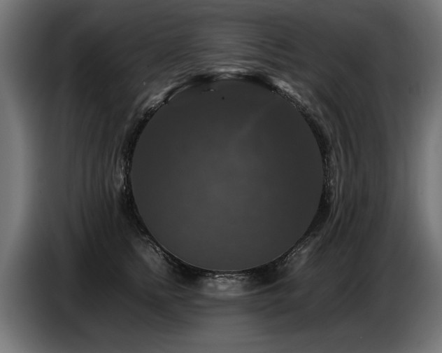 X0000087710758200705041058