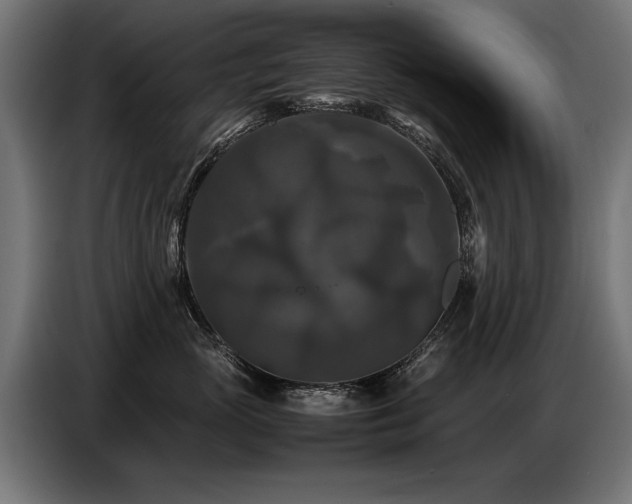 X0000087710765200705041058