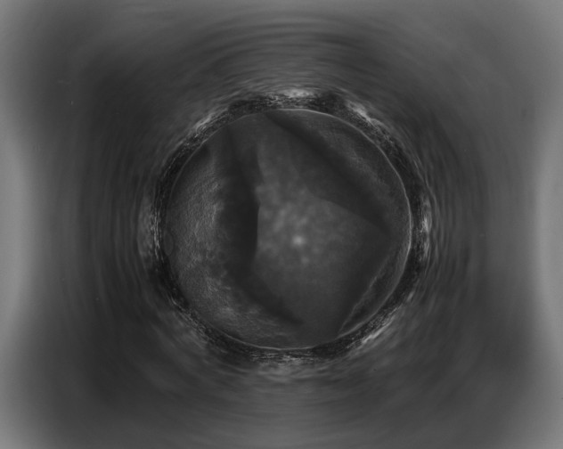 X0000087710772200705041057