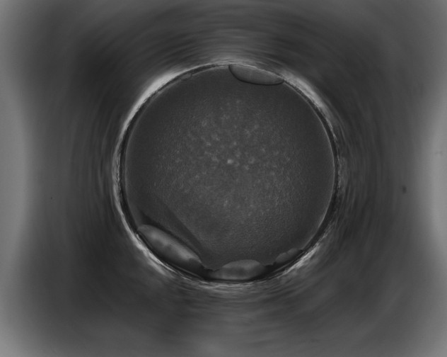 X0000087711048200705041055