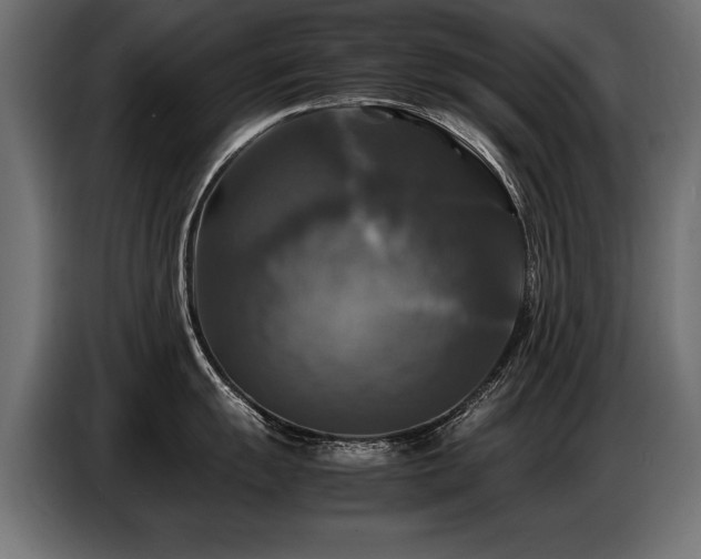 X0000087711055200705041055