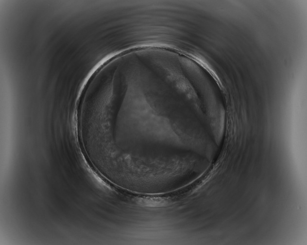 X0000087711092200705041054