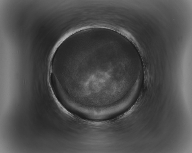 X0000087711520200705041049