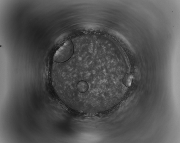 X0000087710918200705111418