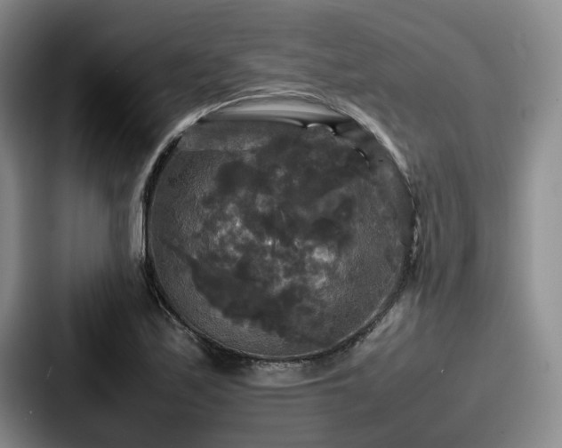 X0000087711171200705111416
