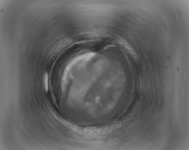 X0000087710022200705181856